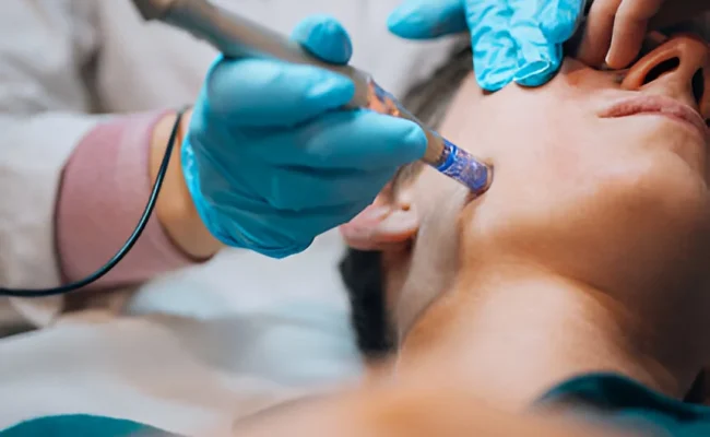 Mesotherapy - Fat Dissolving Injections in Cape Coral, FL