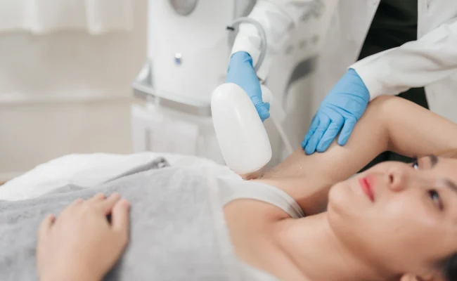 laser hair removal 2